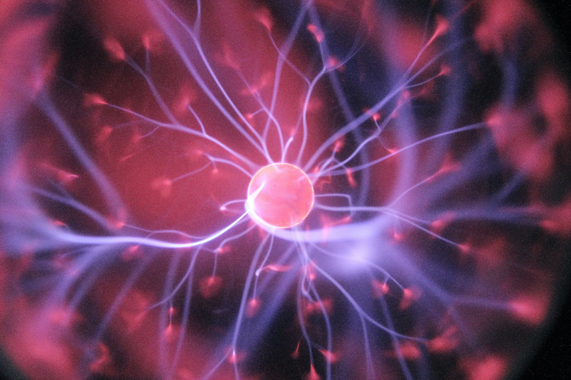 The Personal Network of Knowledge is the New Second Brain